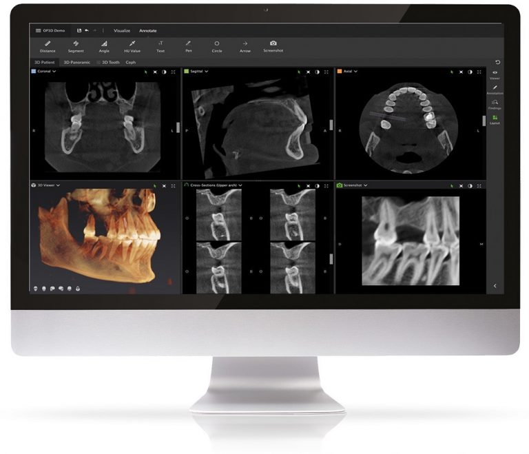 Cone Beam Computed Tomography (CBCT) - Clifton Park Periodontics ...